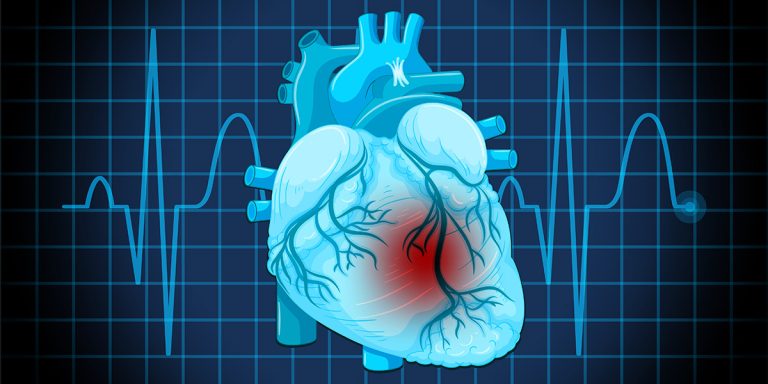 Pourquoi l'absorption du cholestérol compte plus que son taux sanguin