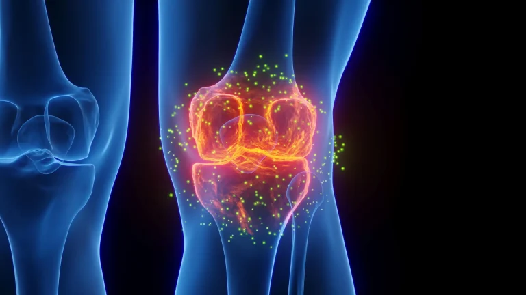 Une alternative mini-invasive pour le traitement de l'arthrose