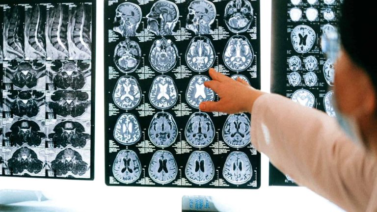 Une neurochirurgie de haute précision sous IRM
