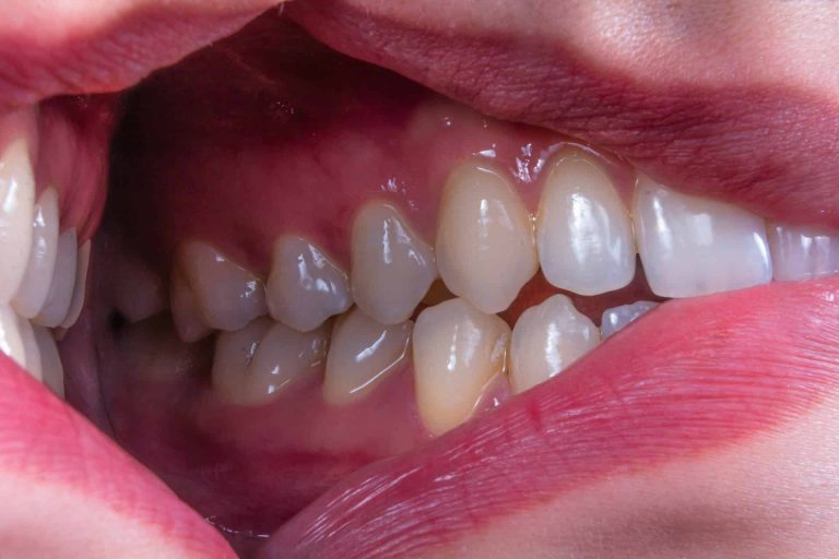 Le protocole ProLon : comment fonctionne le régime imitant le jeûne