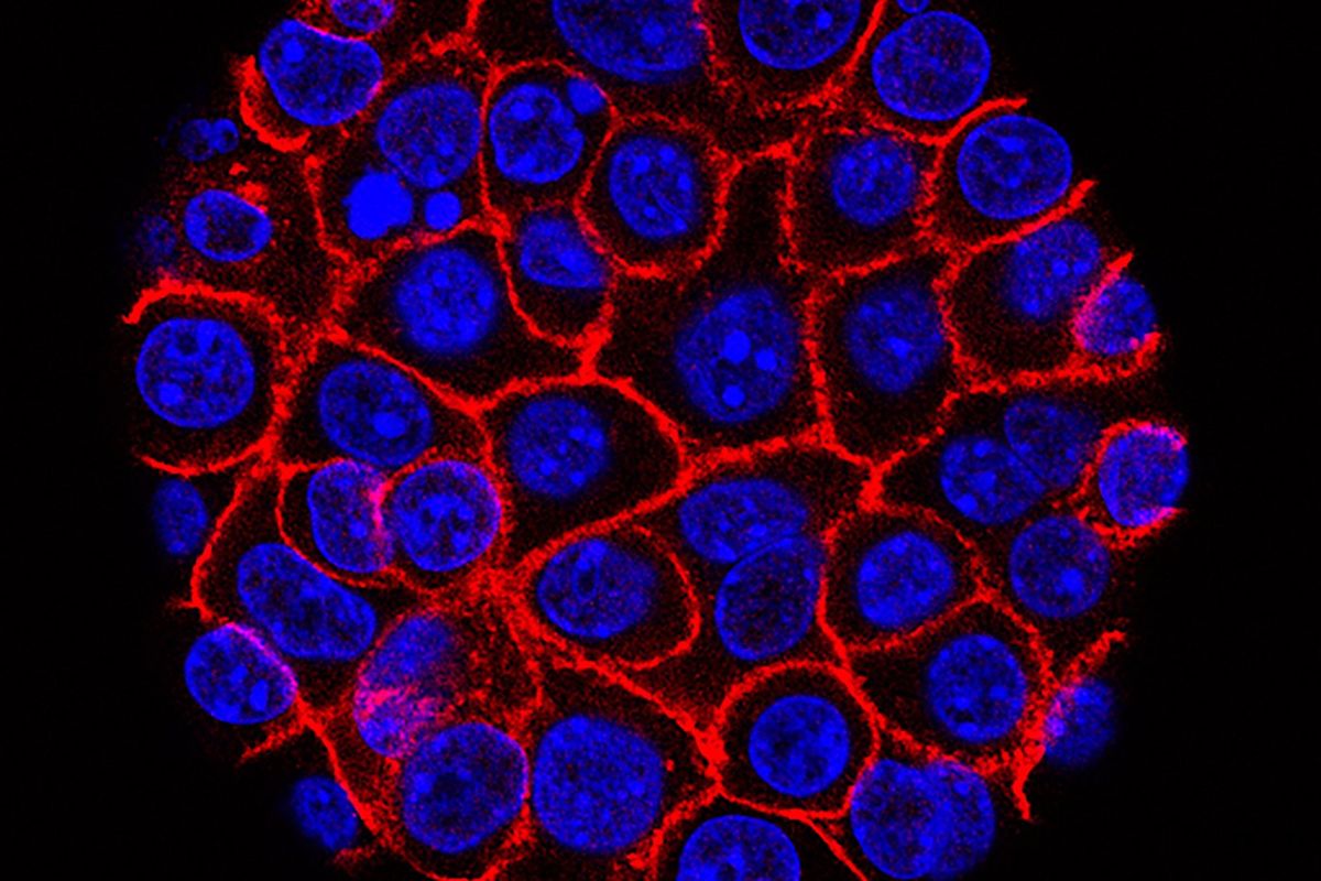 Sémaglutide : une étude relance l'immunité contre le cancer chez les obèses
