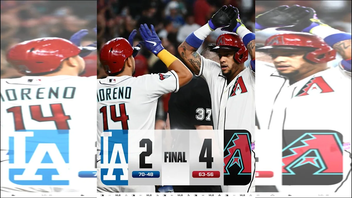 Dodgers : Shohei Ohtani absent des terrains et défaite contre les Diamondbacks