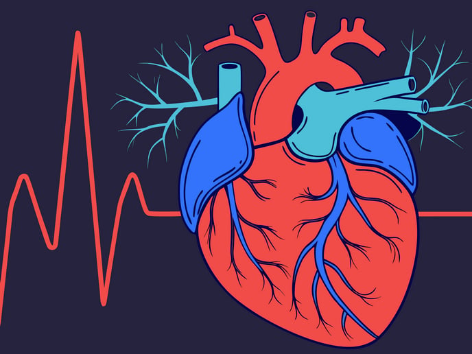 Fibrillation auriculaire : des chercheurs étudient l'ablation par champ pulsé