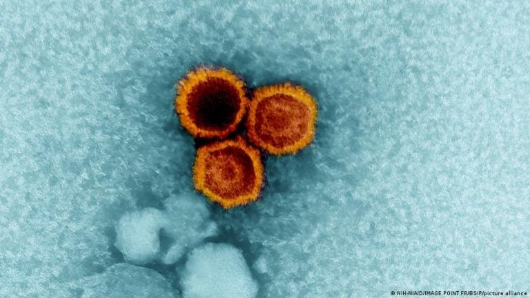Three Epstein-Barr virus (EBV) particles magnified by an electron microscope, colorized red/orange