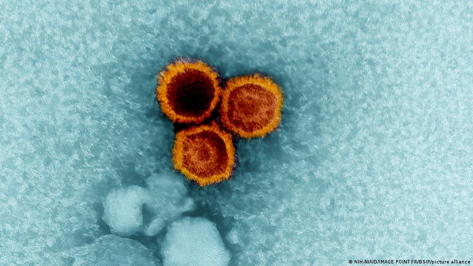 Three Epstein-Barr virus (EBV) particles magnified by an electron microscope, colorized red/orange