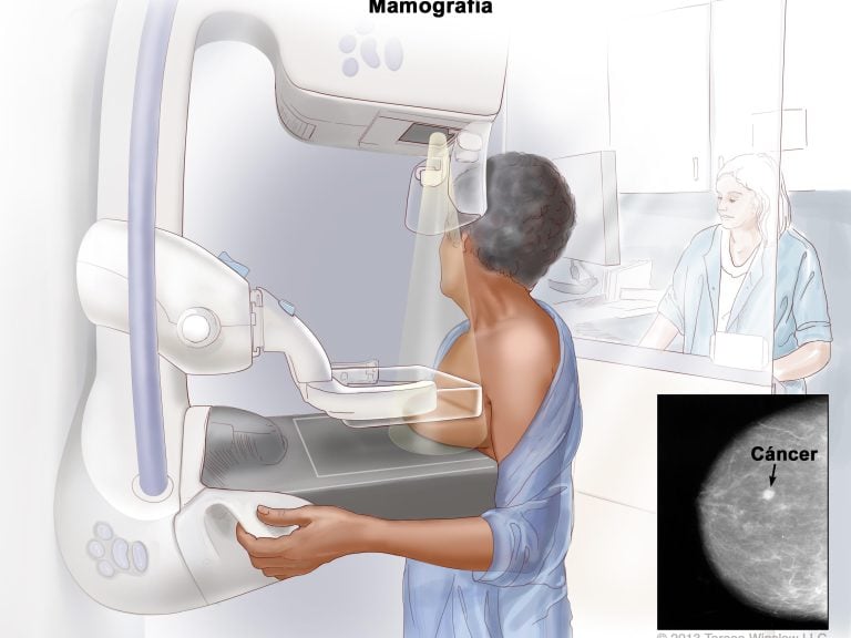 Des Scientifiques Cartographient des Cellules de Cancer du Sein Quiescentes