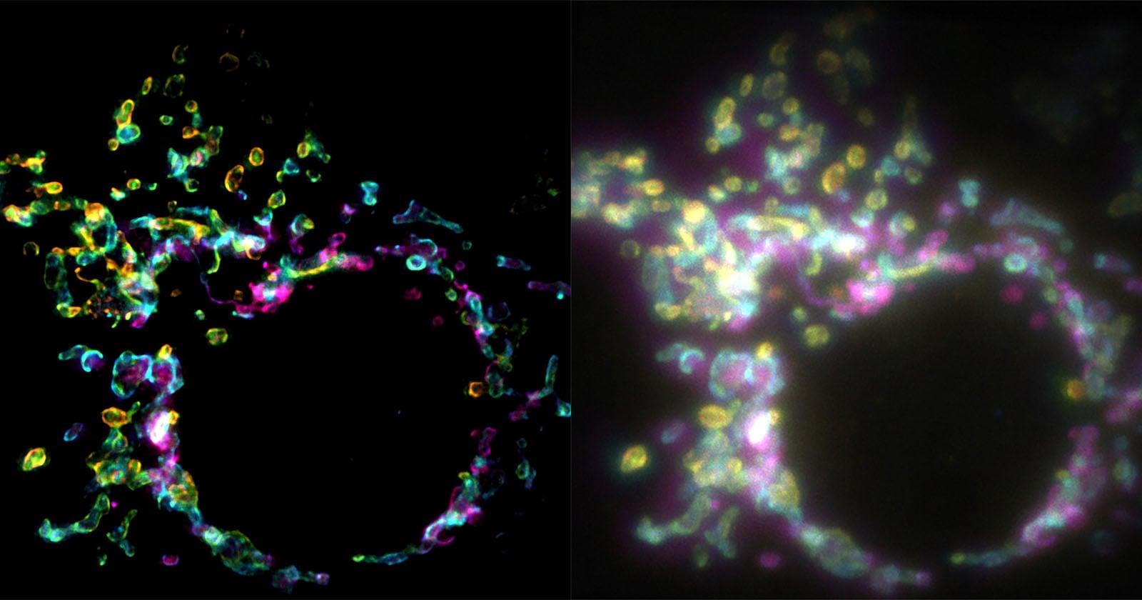 Nouvelle plateforme d'imagerie par IA pour la microscopie à super-résolution