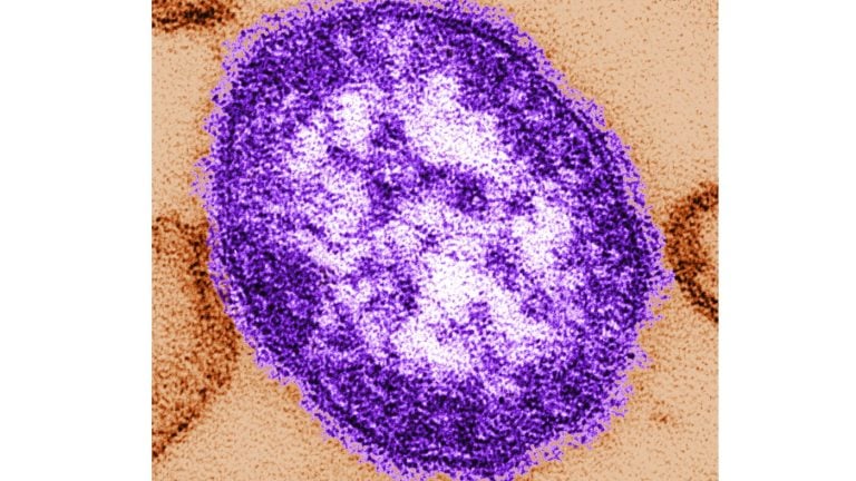 Pennsylvanie : Une Femme Non Vaccinée Décède des Complications de la Rougeole