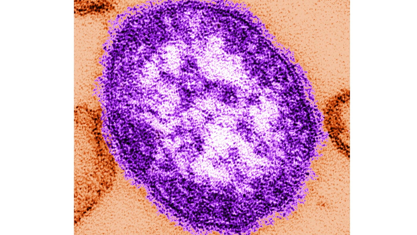 Pennsylvanie : Une Femme Non Vaccinée Décède des Complications de la Rougeole