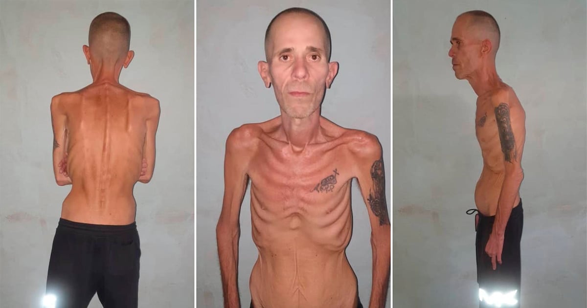 Cuba : Cubalex dénonce une tactique pour éluder la responsabilité des décès de prisonniers