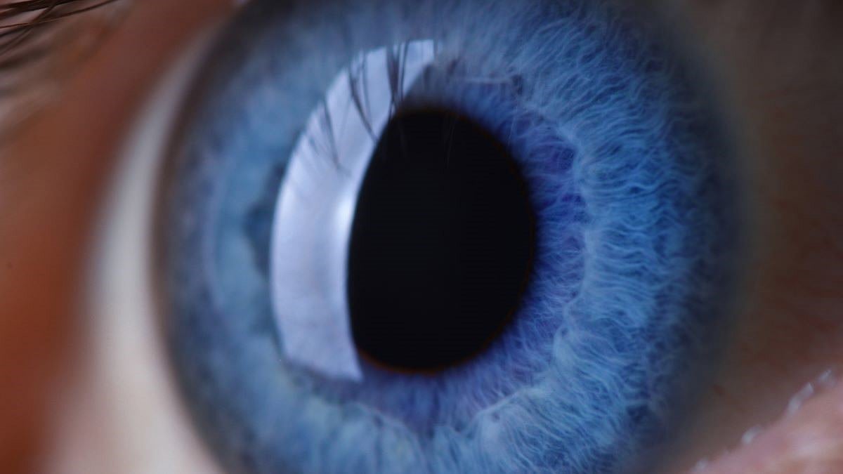 Le psoriasis augmenterait les risques de cataracte et de chirurgie